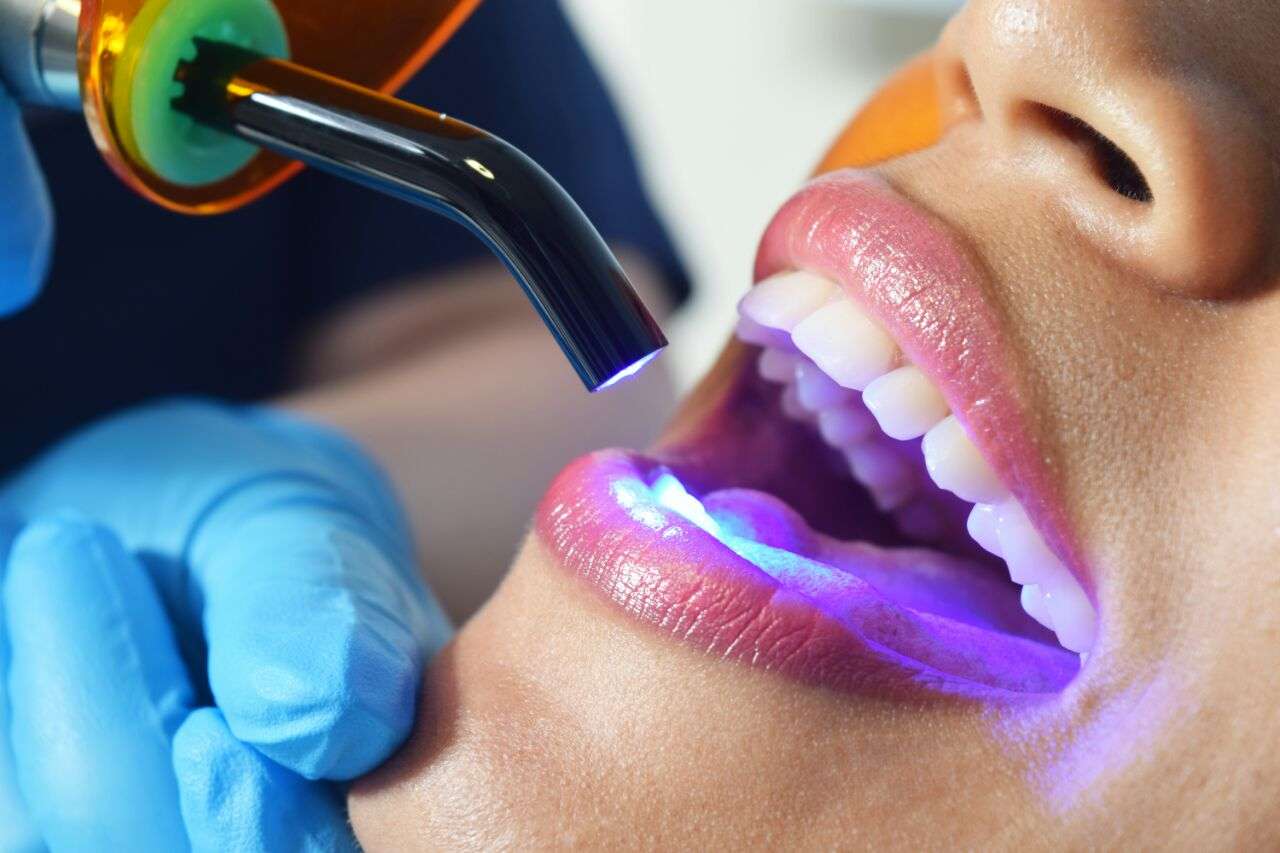 Estética Dental